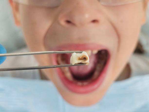 Best Urgent Dental Care for Toothaches in Falfurrias, TX